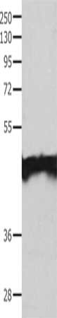Gel: 10%SDS-PAGE, Lysate: 40 ug, Lane: Jurkat cells, Primary antibody: CSB-PA231283(MAT1A Antibody) at dilution 1/200, Secondary antibody: Goat anti rabbit IgG at 1/8000 dilution, Exposure time: 2 minutes