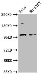 Western Blot Positive WB detected in: Hela whole cell lysate, SH-SY5Y whole cell lysate All lanes: PDE6C antibody at 3.7ug/ml Secondary Goat polyclonal to rabbit IgG at 1/50000 dilution Predicted band size: 100 kDa Observed band size: 100 kDa