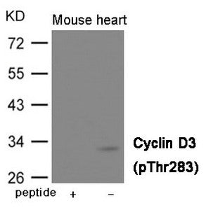 Western blot analysis of extracts from Mouse heart tissue using Cyclin D3 (Phospho-Thr283) Antibody.The lane on the left is treated with the antigen-specific peptide.