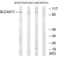 Western blot analysis of extracts from 3T3 cells, RAW264.7 cells and A549 cells, using SLC4A11 antibody.