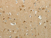 The image on the left is immunohistochemistry of paraffin-embedded Human brain tissue using CSB-PA232265(MCM4 Antibody) at dilution 1/40, on the right is treated with synthetic peptide. (Original magnification: ×200)