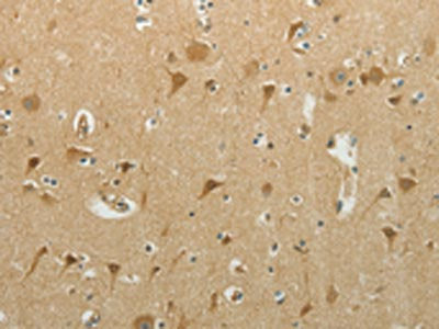 The image on the left is immunohistochemistry of paraffin-embedded Human brain tissue using CSB-PA232265(MCM4 Antibody) at dilution 1/40, on the right is treated with synthetic peptide. (Original magnification: ×200)