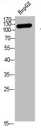 Western blot analysis of hepg2 Cell Lysate, antibody was diluted at 1:1000