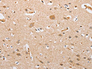 The image on the left is immunohistochemistry of paraffin-embedded Human brain tissue using CSB-PA232532(CSGALNACT2 Antibody) at dilution 1/30, on the right is treated with fusion protein. (Original magnification: ×200)