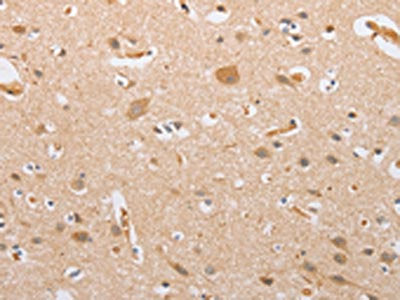 The image on the left is immunohistochemistry of paraffin-embedded Human brain tissue using CSB-PA232532(CSGALNACT2 Antibody) at dilution 1/30, on the right is treated with fusion protein. (Original magnification: ×200)