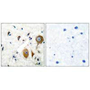 Immunohistochemical analysis of paraffin-embedded human brain tissue using GluR8 antibody.