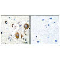 Immunohistochemical analysis of paraffin-embedded human brain tissue using GluR8 antibody.