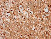 IHC image of CSB-PA23279A0Rb diluted at 1:300 and staining in paraffin-embedded human brain tissue performed on a Leica BondTM system. After dewaxing and hydration, antigen retrieval was mediated by high pressure in a citrate buffer (pH 6.0). Sect...