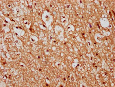 IHC image of CSB-PA23279A0Rb diluted at 1:300 and staining in paraffin-embedded human brain tissue performed on a Leica BondTM system. After dewaxing and hydration, antigen retrieval was mediated by high pressure in a citrate buffer (pH 6.0). Sect...