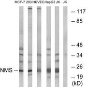 Western blot analysis of extracts from MCF-7 cells, 293 cells, HUVEC cells, HepG2 cells and Jurkat cells, using NMS antibody.