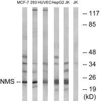 Western blot analysis of extracts from MCF-7 cells, 293 cells, HUVEC cells, HepG2 cells and Jurkat cells, using NMS antibody.