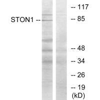 Western blot analysis of extracts from K562 cells, using STON1 antibody.