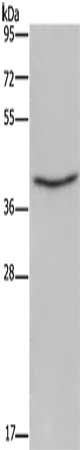 Gel: 10%SDS-PAGE, Lysate: 40 ug, Lane: A172 cells, Primary antibody: CSB-PA233280(ELAVL3 Antibody) at dilution 1/450, Secondary antibody: Goat anti rabbit IgG at 1/8000 dilution, Exposure time: 5 minutes