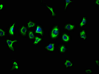 Immunofluorescence staining of A549 cells with CSB-PA23379A0Rb at 1:133, counter-stained with DAPI. The cells were fixed in 4% formaldehyde, permeabilized using 0.2% Triton X-100 and blocked in 10% normal Goat Serum. The cells were then incubated...