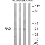 Western blot analysis of extracts from HeLa cells, HepG2 cells and MCF-7 cells, using RAD antibody.