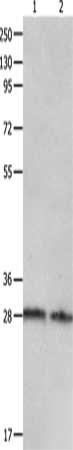 Gel: 10+12%SDS-PAGE, Lysate: 40 ug, Lane 1-2: Mouse intestinum tenue tissue, Mouse heart tissue, Primary antibody: CSB-PA233817(CA2 Antibody) at dilution 1/250, Secondary antibody: Goat anti rabbit IgG at 1/8000 dilution, Exposure time: 1 minute