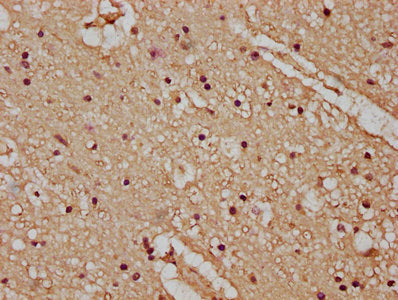 IHC image of CSB-PA23389A0Rb diluted at 1:100 and staining in paraffin-embedded human brain tissue performed on a Leica BondTM system. After dewaxing and hydration, antigen retrieval was mediated by high pressure in a citrate buffer (pH 6.0). Sect...