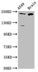 Western Blot Positive WB detected in: A549 whole cell lysate, Rat brain tissue All lanes: CABIN1 antibody at 3.1µg/ml Secondary Goat polyclonal to rabbit IgG at 1/50000 dilution Predicted band size: 247, 238 kDa Observed band size: 247 kDa