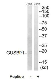 Western blot analysis of extracts from K562 cells, using GUSBP1 antibody.