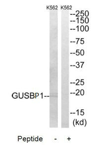 Western blot analysis of extracts from K562 cells, using GUSBP1 antibody.