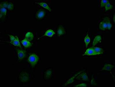 Immunofluorescence staining of MCF-7 cells with CSB-PA23409A0Rb at 1:100, counter-stained with DAPI. The cells were fixed in 4% formaldehyde, permeabilized using 0.2% Triton X-100 and blocked in 10% normal Goat Serum. The cells were then incubated...