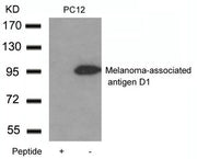 Western blot analysis of extracts from PC12 cells using Melanoma-associated antigen D1 Antibody and the same antibody preincubated with blocking peptide.