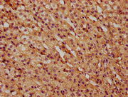 IHC image of CSB-PA23419A0Rb diluted at 1:500 and staining in paraffin-embedded human adrenal gland tissue performed on a Leica BondTM system. After dewaxing and hydration, antigen retrieval was mediated by high pressure in a citrate buffer (pH 6....
