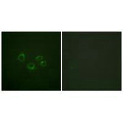 Immunofluorescence analysis of A549 cells, using EPHA2/3/4 (Ab-588/596) antibody.