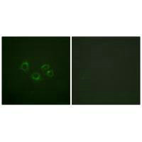 Immunofluorescence analysis of A549 cells, using EPHA2/3/4 (Ab-588/596) antibody.