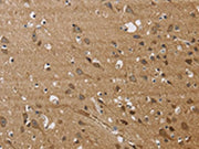 The image on the left is immunohistochemistry of paraffin-embedded Human brain tissue using CSB-PA234352(JAG1 Antibody) at dilution 1/40, on the right is treated with synthetic peptide. (Original magnification: ×200)