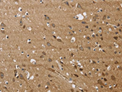 The image on the left is immunohistochemistry of paraffin-embedded Human brain tissue using CSB-PA234352(JAG1 Antibody) at dilution 1/40, on the right is treated with synthetic peptide. (Original magnification: ×200)