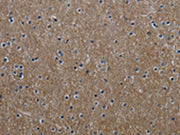 The image on the left is immunohistochemistry of paraffin-embedded Human brain tissue using CSB-PA234599(GNG2 Antibody) at dilution 1/60, on the right is treated with fusion protein. (Original magnification: ×200)