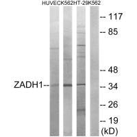 Western blot analysis of extracts from HUVEC cells, K562 cells and HT-29 cells, using ZADH1 antibody.