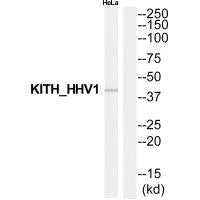 Western blot analysis of extracts from HeLa cells, using KITH_HHV1 antibody.