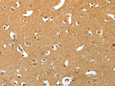 The image on the left is immunohistochemistry of paraffin-embedded Human brain tissue using CSB-PA234912(TNR Antibody) at dilution 1/50, on the right is treated with synthetic peptide. (Original magnification: ×200)
