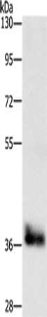 Gel: 10%SDS-PAGE, Lysate: 40 ug, Lane: Mouse liver tissue, Primary antibody: CSB-PA235012(CEBPE Antibody) at dilution 1/650, Secondary antibody: Goat anti rabbit IgG at 1/8000 dilution, Exposure time: 30 seconds