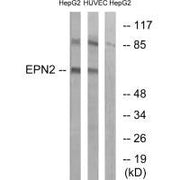 Western blot analysis of extracts from HepG2 cells and HUVEC cells, using EPN2 antibody.