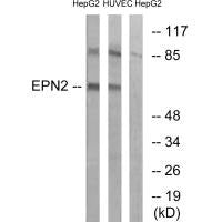 Western blot analysis of extracts from HepG2 cells and HUVEC cells, using EPN2 antibody.