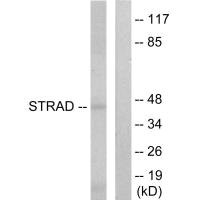 Western blot analysis of extracts from HepG2 cells, using STRAD antibody.