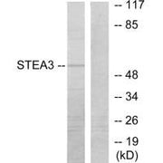 Western blot analysis of extracts from COLO205 cells, using STEA3 antibody.