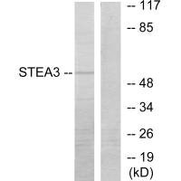 Western blot analysis of extracts from COLO205 cells, using STEA3 antibody.