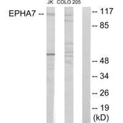 Western blot analysis of extracts from Jurkat cells and COLO205 cells, using EPHA7 antibody.