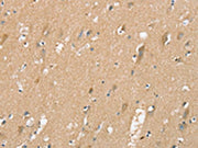 The image on the left is immunohistochemistry of paraffin-embedded Human brain tissue using CSB-PA235687(SIGLEC10 Antibody) at dilution 1/25, on the right is treated with synthetic peptide. (Original magnification: x200)