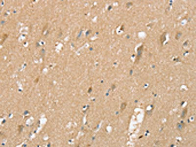 The image on the left is immunohistochemistry of paraffin-embedded Human brain tissue using CSB-PA235687(SIGLEC10 Antibody) at dilution 1/25, on the right is treated with synthetic peptide. (Original magnification: x200)