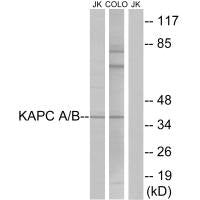 Western blot analysis of extracts from Jurkat cells and COLO cells, using KAPC A/B antibody.