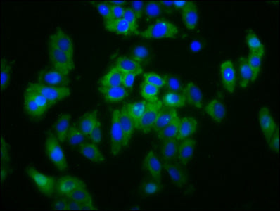 Immunofluorescence staining of HepG2 cells with CSB-PA23589A0Rb at 1:133, counter-stained with DAPI. The cells were fixed in 4% formaldehyde, permeabilized using 0.2% Triton X-100 and blocked in 10% normal Goat Serum. The cells were then incubated...