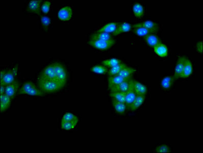 Immunofluorescence staining of PC-3 cells with CSB-PA23619A0Rb at 1:133, counter-stained with DAPI. The cells were fixed in 4% formaldehyde, permeabilized using 0.2% Triton X-100 and blocked in 10% normal Goat Serum. The cells were then incubated...