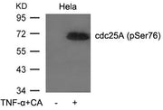 Western blot analysis of extracts from Hela cells untreated or treated with TNF-a and CA using cdc25A(Phospho-Ser76) Antibody.