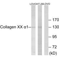 Western blot analysis of extracts from HUVEC cells, using Collagen XX α1 antibody.