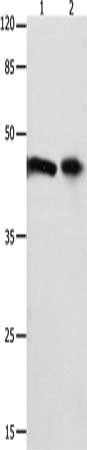 Gel: 10%SDS-PAGE, Lysate: 40 ug, Lane 1-2: 293T cells, mouse intestinum tenue tissue, Primary antibody: CSB-PA236731(FOXL1 Antibody) at dilution 1/850, Secondary antibody: Goat anti rabbit IgG at 1/8000 dilution, Exposure time: 30 seconds